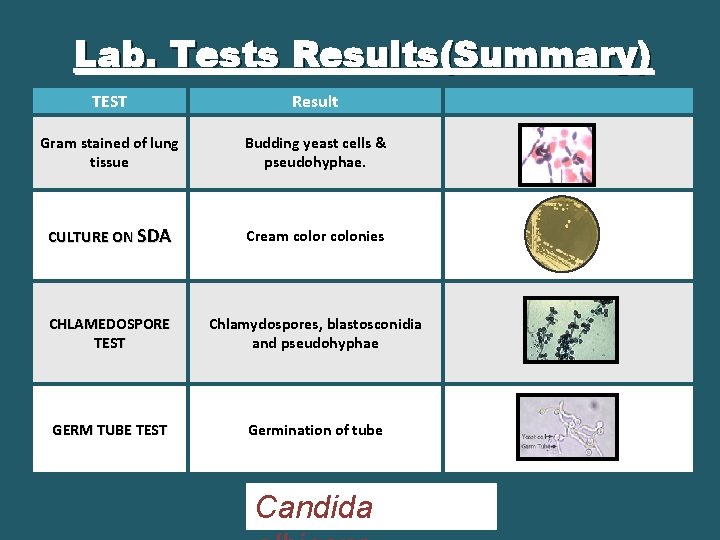 Lab. Tests Results(Summary) TEST Result Gram stained of lung tissue Budding yeast cells &