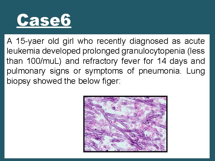 Case 6 A 15 -yaer old girl who recently diagnosed as acute leukemia developed