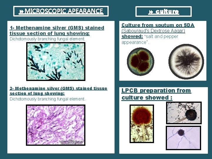  MICROSCOPIC APEARANCE 1 - Methenamine silver (GMS) stained tissue section of lung showing: