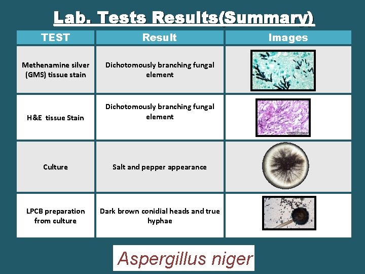 Lab. Tests Results(Summary) TEST Result Methenamine silver (GMS) tissue stain Dichotomously branching fungal element