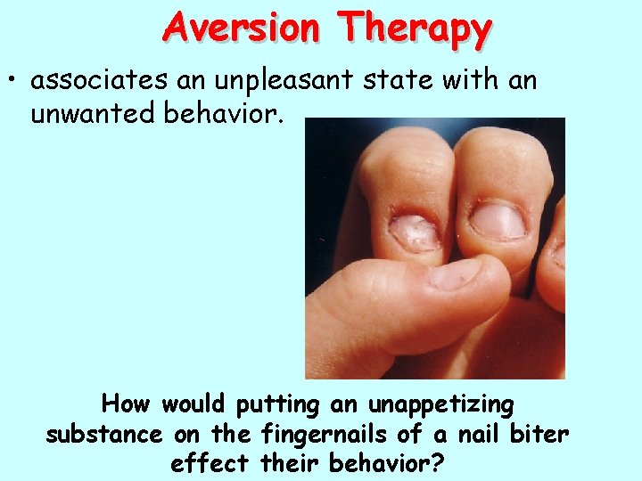 Aversion Therapy • associates an unpleasant state with an unwanted behavior. How would putting