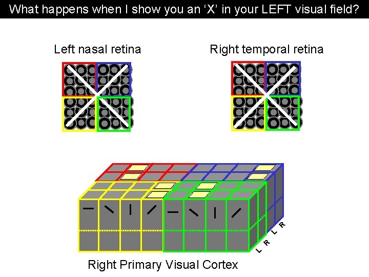 What happens when I show you an ‘X’ in your LEFT visual field? Left