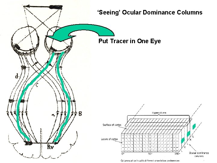 ‘Seeing’ Ocular Dominance Columns Put Tracer in One Eye 
