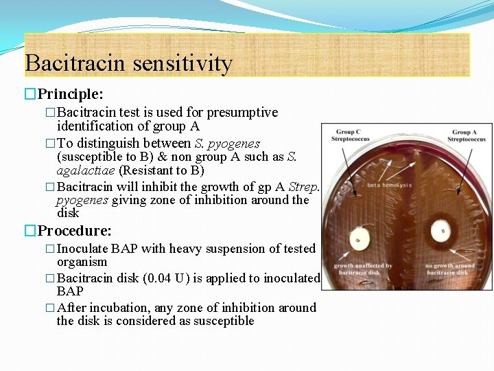 Bacitracin sensitivity �Principle: � Bacitracin test is used for presumptive identification of group A