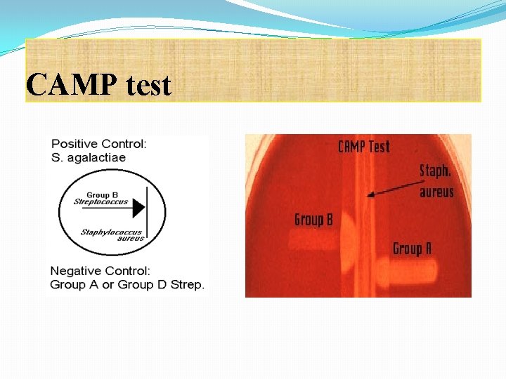 CAMP test 