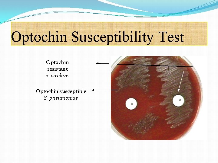 Optochin Susceptibility Test Optochin resistant S. viridans Optochin susceptible S. pneumoniae 