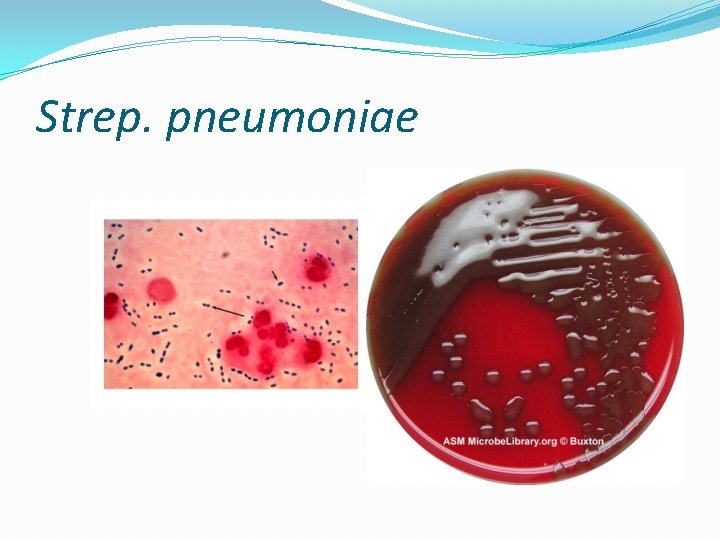 Strep. pneumoniae 