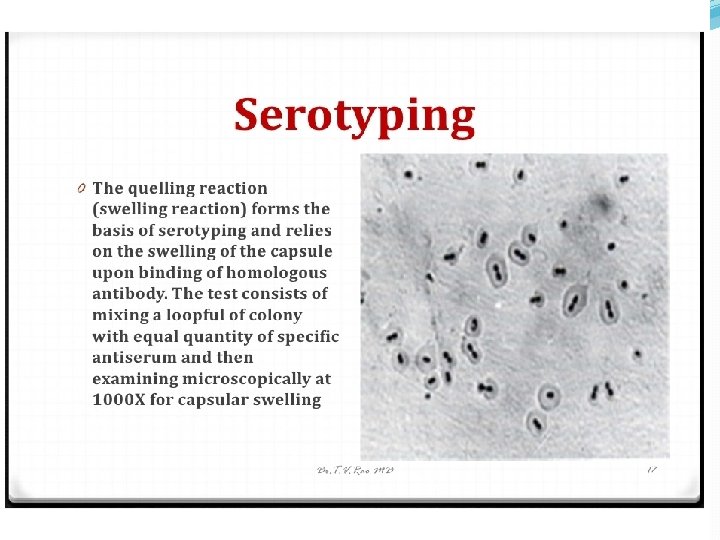 Strep pneumonia capsule 