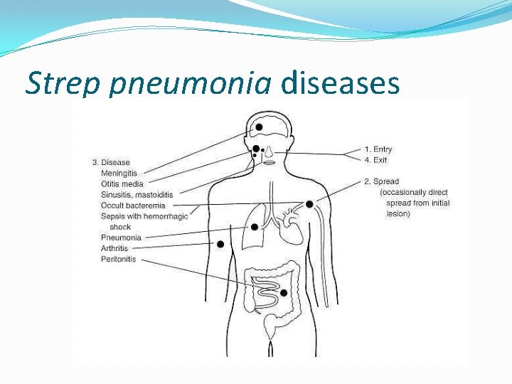 Strep pneumonia diseases 