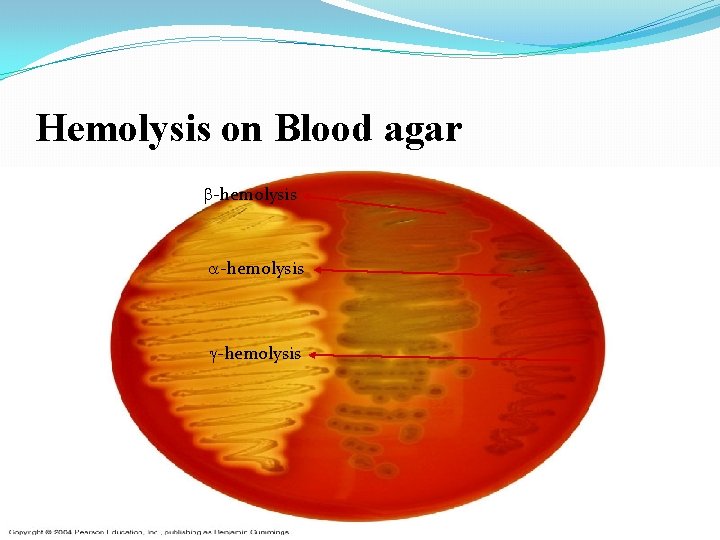 Hemolysis on Blood agar -hemolysis 