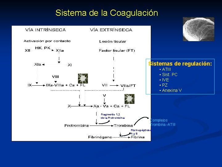 Sistema de la Coagulación Sistemas de regulación: • ATIII • Sist. PC • IVE