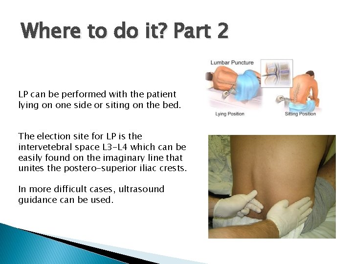 Where to do it? Part 2 LP can be performed with the patient lying