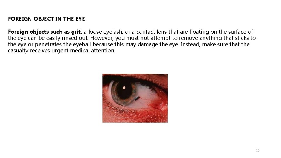 FOREIGN OBJECT IN THE EYE Foreign objects such as grit, a loose eyelash, or