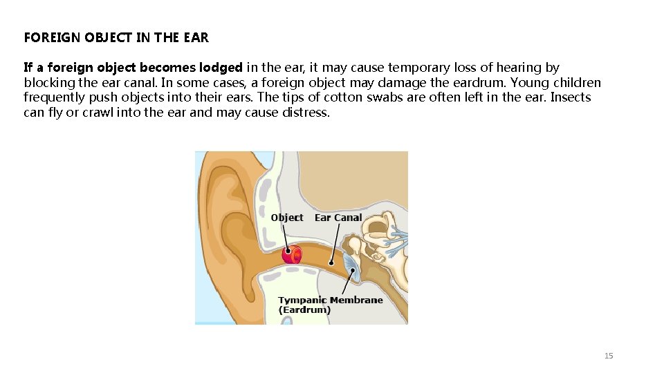 FOREIGN OBJECT IN THE EAR If a foreign object becomes lodged in the ear,