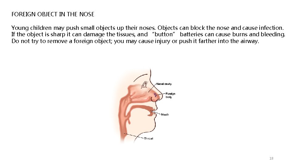 FOREIGN OBJECT IN THE NOSE Young children may push small objects up their noses.