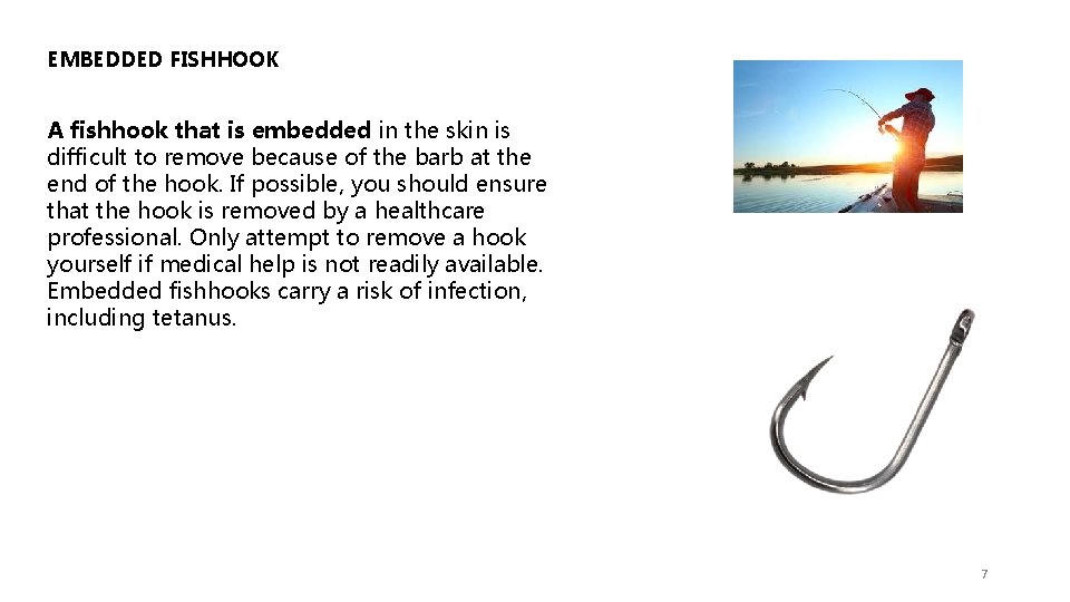 EMBEDDED FISHHOOK A fishhook that is embedded in the skin is difficult to remove