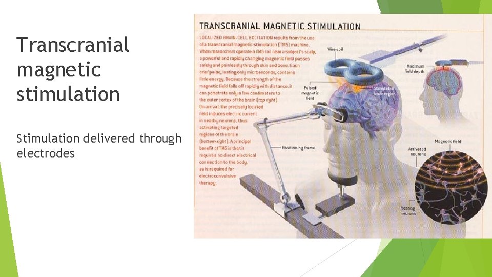 Transcranial magnetic stimulation Stimulation delivered through electrodes 