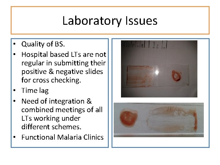 Laboratory Issues • Quality of BS. • Hospital based LTs are not regular in