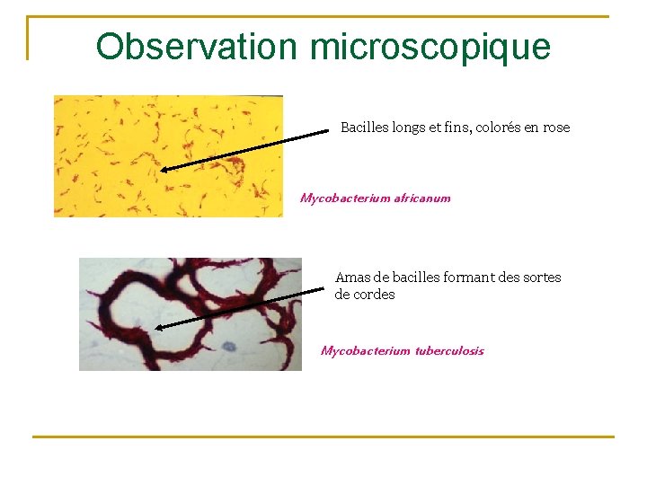 Observation microscopique Bacilles longs et fins, colorés en rose Mycobacterium africanum Amas de bacilles