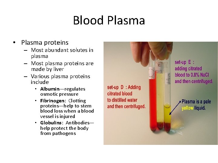 Blood Plasma • Plasma proteins – Most abundant solutes in plasma – Most plasma