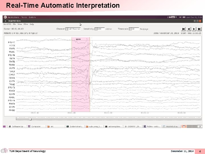 Real-Time Automatic Interpretation TUH Department of Neurology December 11, 2014 4 