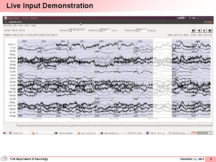 Live Input Demonstration TUH Department of Neurology December 11, 2014 77 
