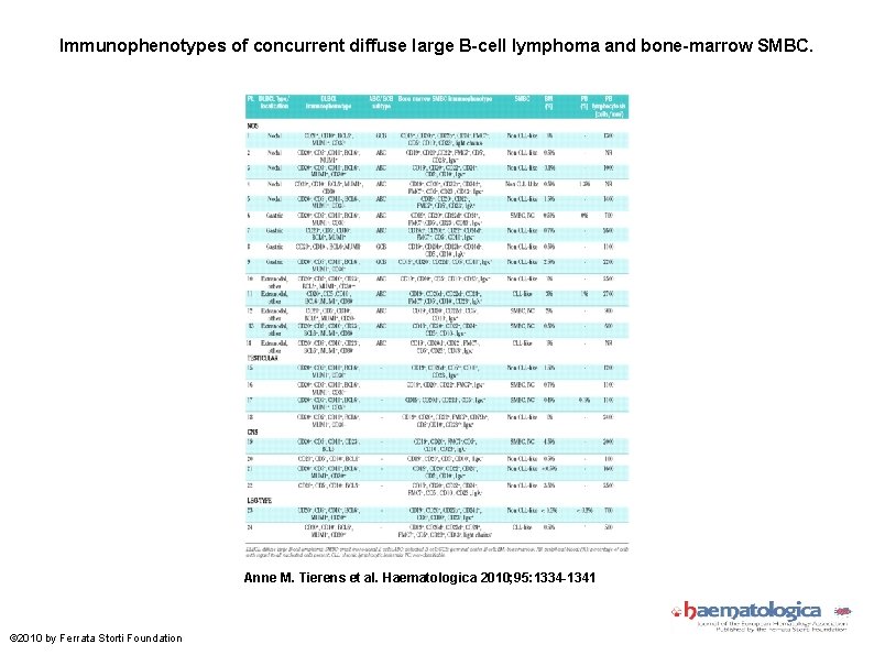 Immunophenotypes of concurrent diffuse large B-cell lymphoma and bone-marrow SMBC. Anne M. Tierens et
