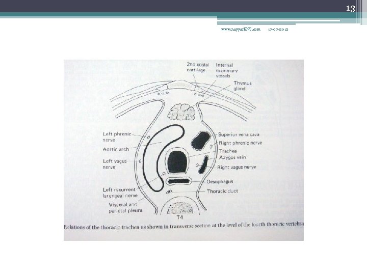 13 www. nayyar. ENT. com 17 -07 -2012 