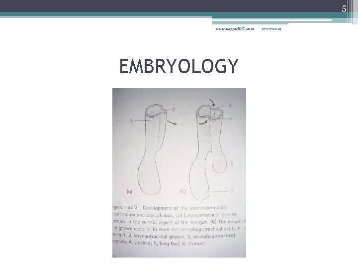 5 www. nayyar. ENT. com EMBRYOLOGY 17 -07 -2012 