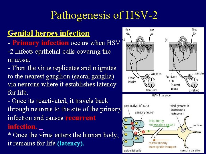 Pathogenesis of HSV-2 Genital herpes infection - Primary infection occurs when HSV -2 infects