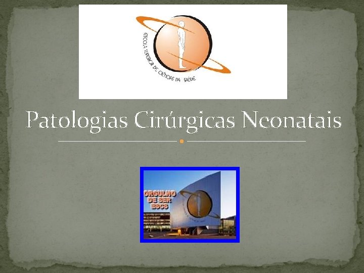 Patologias Cirúrgicas Neonatais 