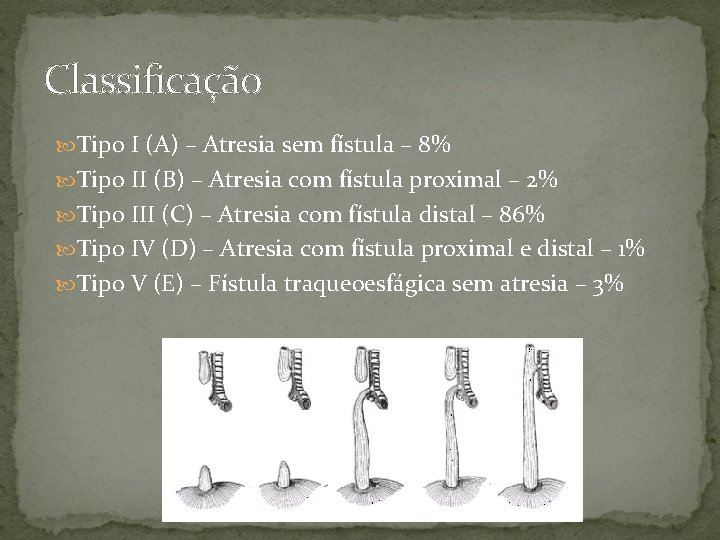 Classificação Tipo I (A) – Atresia sem fístula – 8% Tipo II (B) –