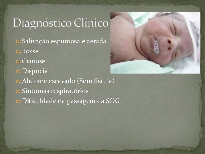  Salivação espumosa e aerada Tosse Cianose Dispneia Abdome escavado (Sem fístula) Sintomas respiratórios