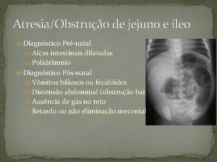 Atresia/Obstrução de jejuno e íleo Diagnóstico Pré-natal Alças intestinais dilatadas Polidrâmnio Diagnóstico Pós-natal Vômitos