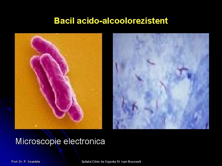 Bacil acido-alcoolorezistent Microscopie electronica Prof. Dr. P. Geavlete Spitalul Clinic de Urgenta Sf. Ioan