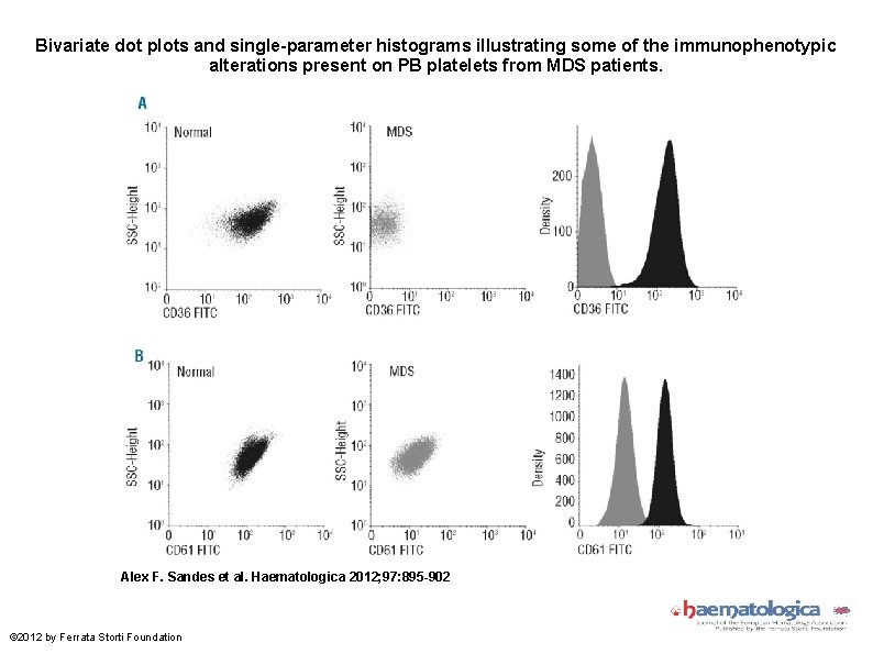 Bivariate dot plots and single-parameter histograms illustrating some of the immunophenotypic alterations present on