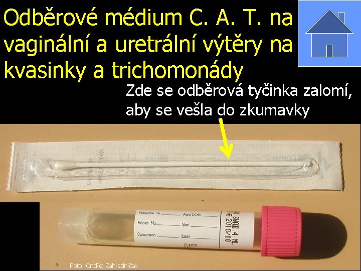 Odběrové médium C. A. T. na vaginální a uretrální výtěry na kvasinky a trichomonády