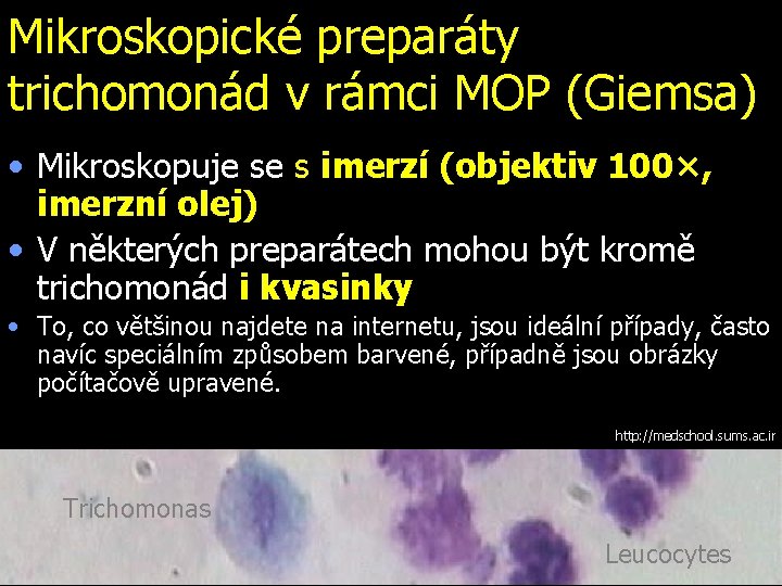 Mikroskopické preparáty trichomonád v rámci MOP (Giemsa) • Mikroskopuje se s imerzí (objektiv 100×,