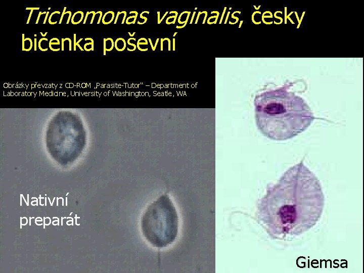 Trichomonas vaginalis, česky bičenka poševní Obrázky převzaty z CD-ROM „Parasite-Tutor“ – Department of Laboratory