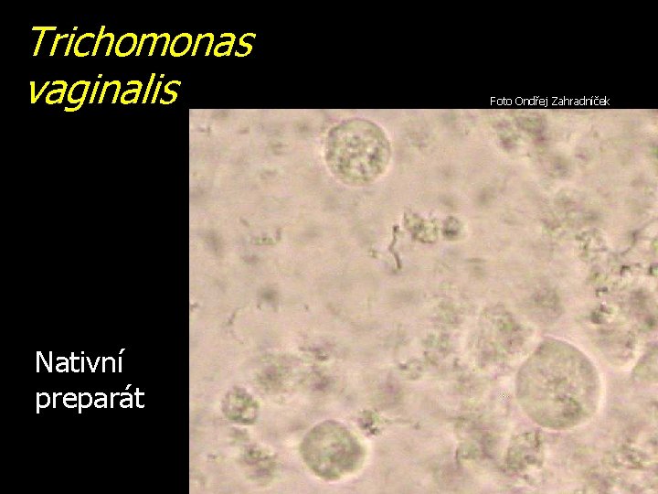 Trichomonas vaginalis Nativní preparát Foto Ondřej Zahradníček 