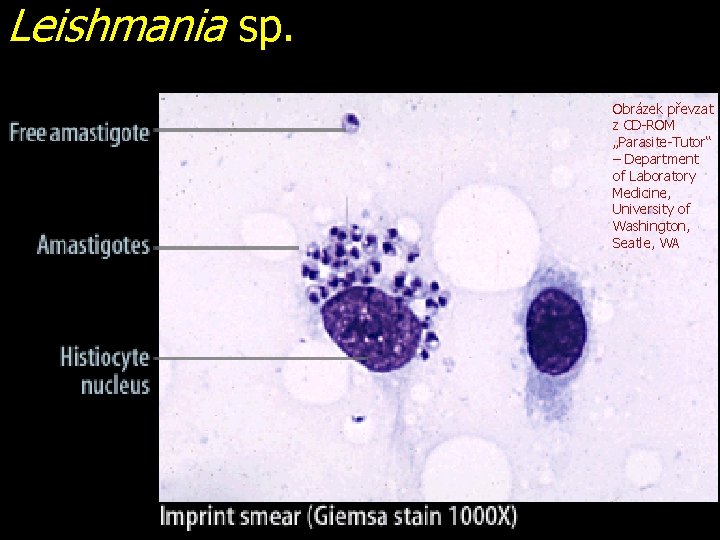 Leishmania sp. Obrázek převzat z CD-ROM „Parasite-Tutor“ – Department of Laboratory Medicine, University of