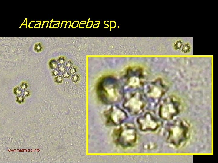 Acantamoeba sp. www. medmicro. info 