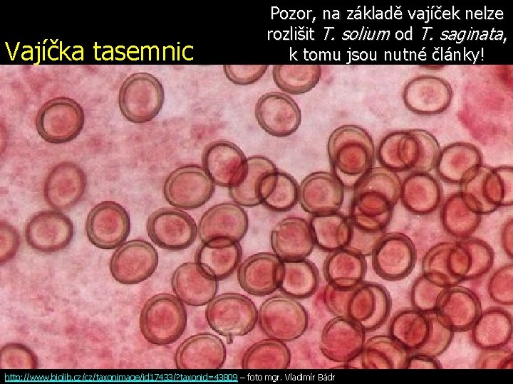 Vajíčka tasemnic Pozor, na základě vajíček nelze rozlišit T. solium od T. saginata, k