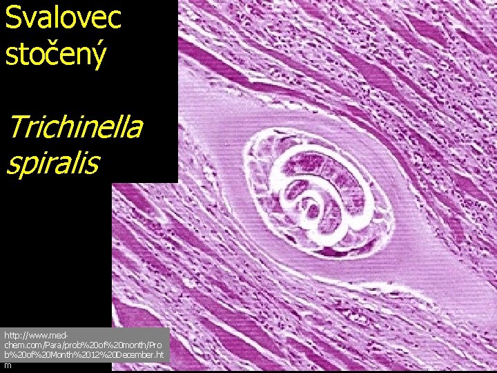 Svalovec stočený Trichinella spiralis http: //www. medchem. com/Para/prob%20 of%20 month/Pro b%20 of%20 Month%2012%20 December.