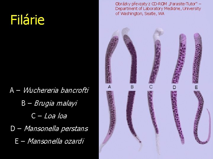 Filárie A – Wuchereria bancrofti B – Brugia malayi C – Loa loa D