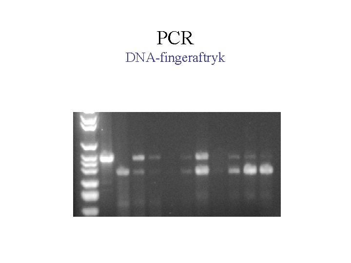 PCR DNA-fingeraftryk 