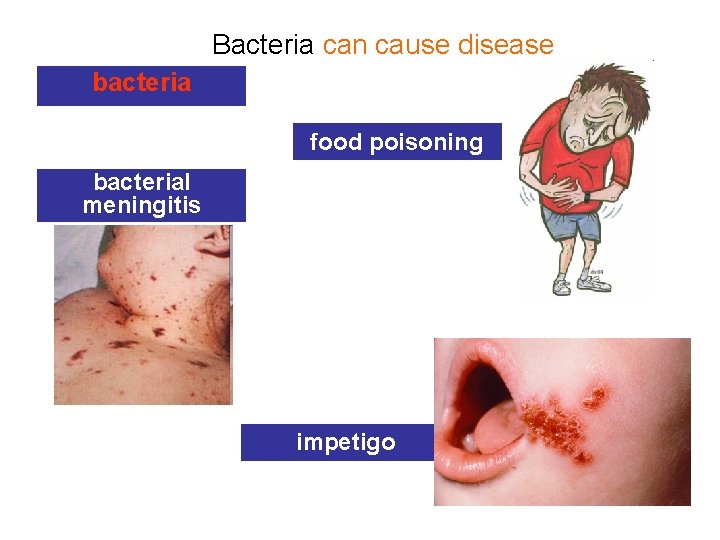 Bacteria can cause disease bacteria food poisoning bacterial meningitis impetigo 