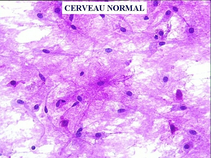 CERVEAU NORMAL 