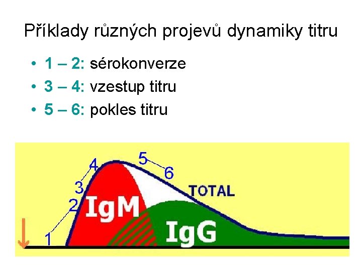 Příklady různých projevů dynamiky titru • 1 – 2: sérokonverze • 3 – 4: