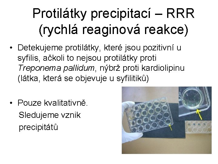 Protilátky precipitací – RRR (rychlá reaginová reakce) • Detekujeme protilátky, které jsou pozitivní u